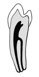 Canali - Secondo canale premolare inferiore