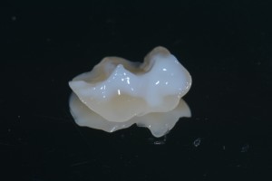 Teflon in odontoiatria - Stampaggio prime classi 4