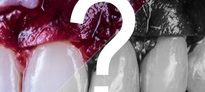 COSA DIAVOLO E’ QUESTA GESTIONE DEI TESSUTI MOLLI?