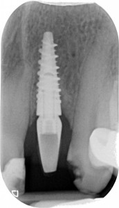 gestione dei tessuti molli -rx