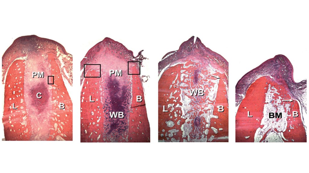 Quando-togli-un-dente-succede-una-cosa-incredibile