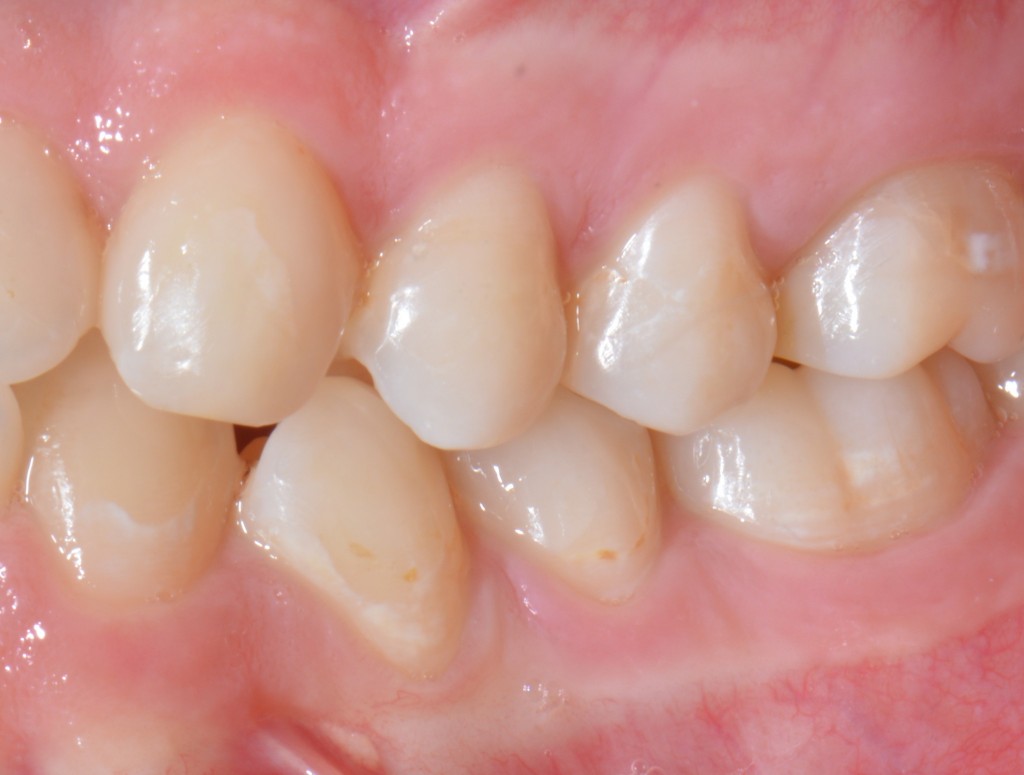 Sacra tecnica della doppia matrice 4