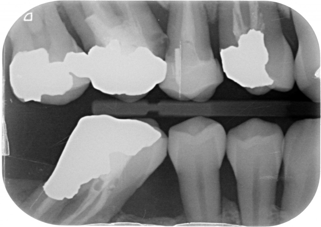 Sacra tecnica della doppia matrice 6