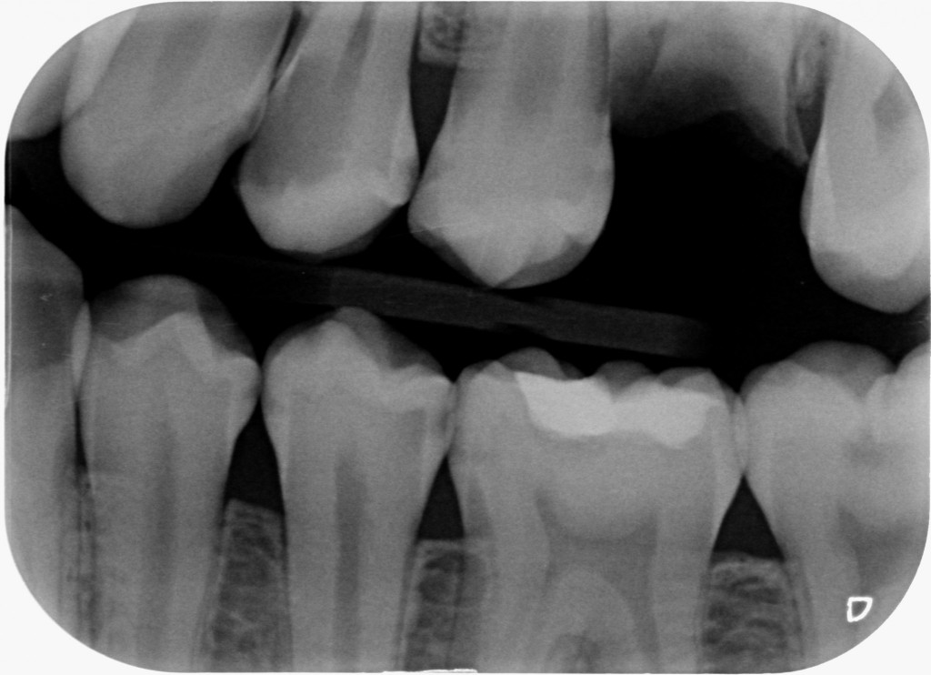 Sacra tecnica della doppia matrice 1