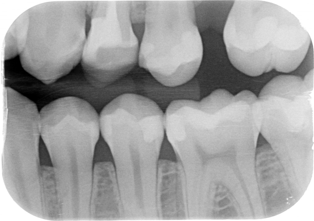 Sacra tecnica della doppia matrice 3