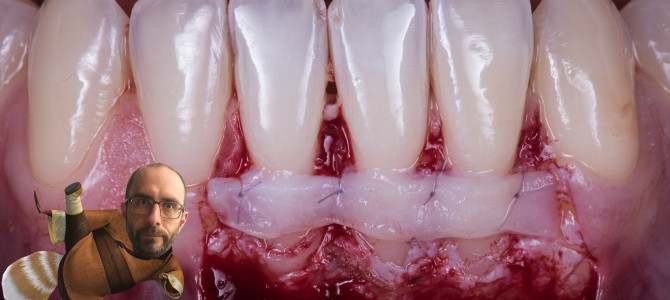 SEI PRONTO PER IL SECONDO SEGRETO?