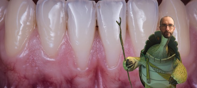 (Video) LA PRIMA TECNICA SEGRETA PER NON ACCORCIARE IL FORNICE IN CHIRURGIA MUCOGENGIVALE