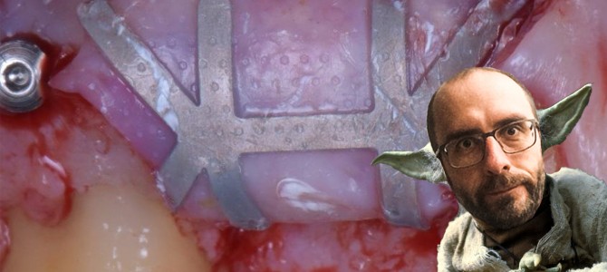 DELLA CHIRURGIA AVANZATA, QUESTO SEGRETO, CONOSCERE TU DEVI!