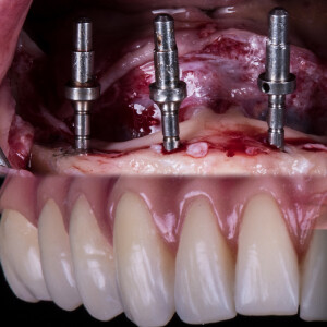 iMG PRODOTTO formazioneodontoiatrica