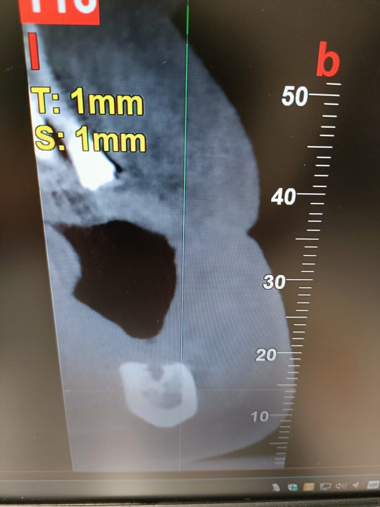 TC nervo formazione odontoiatrica