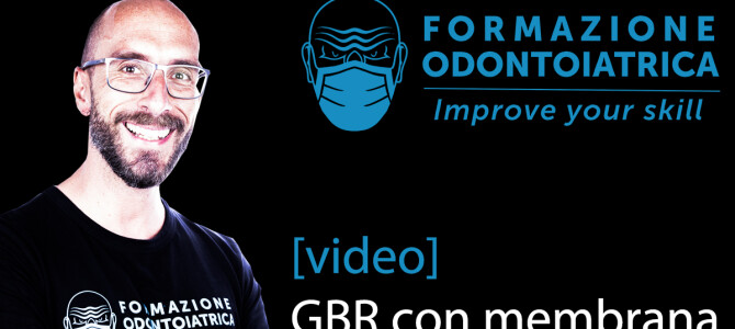 [VIDEO] RIGENERAZIONE OSSEA GUIDATA CON UNA NUOVA MEMBRANA IN MAGNESIO RIASSORBIBILE… PROVIAMOLA!