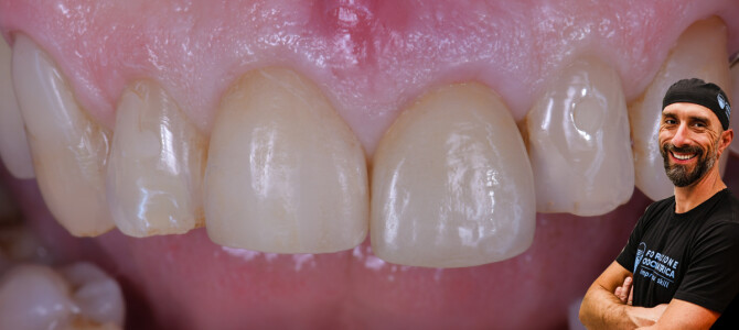 [video] COME FACCIO IO LA SOCKET SHIELD… BECCATI TUTTI I DETTAGLI